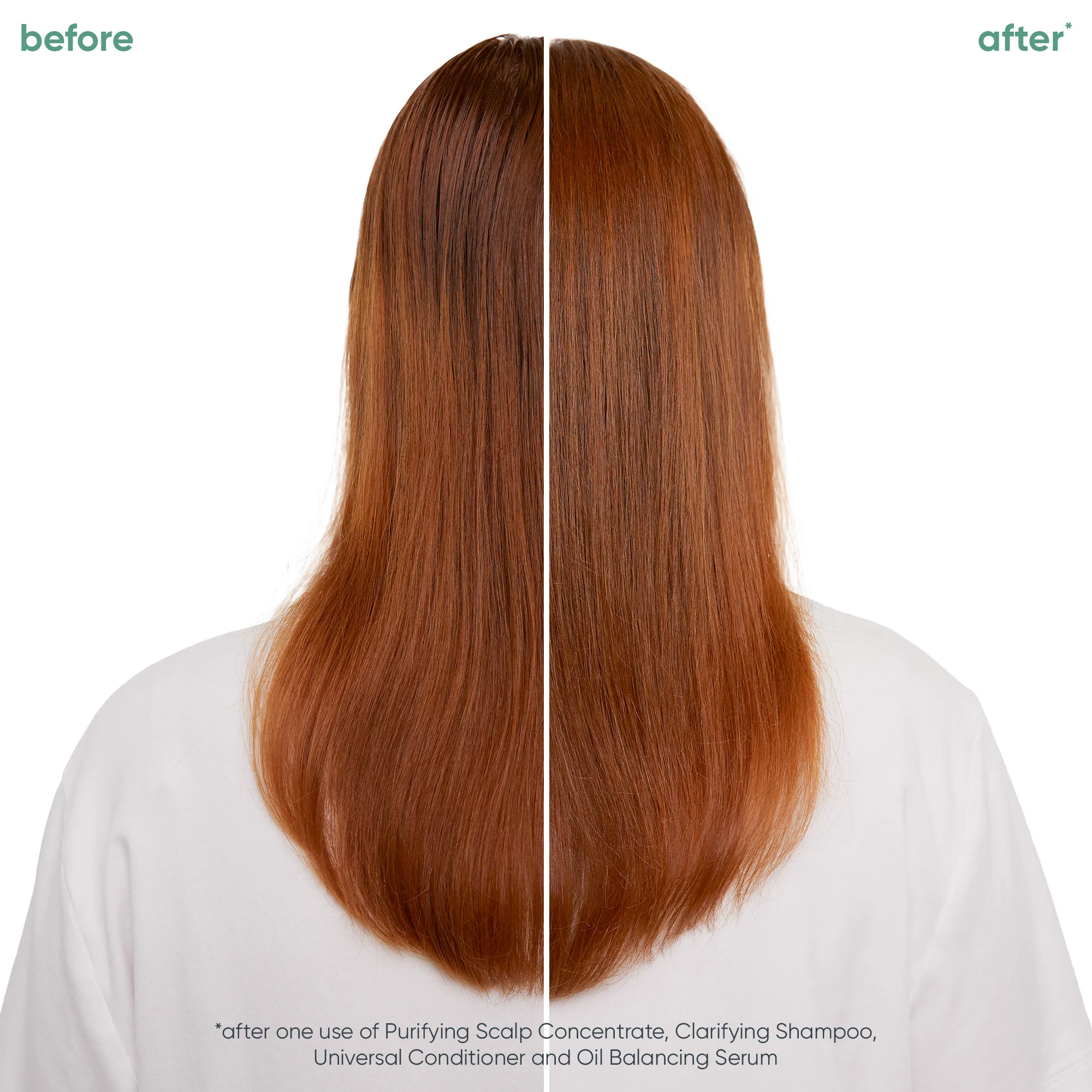 Scalp Sync Oil Balancing Serum 50ml - Image 2