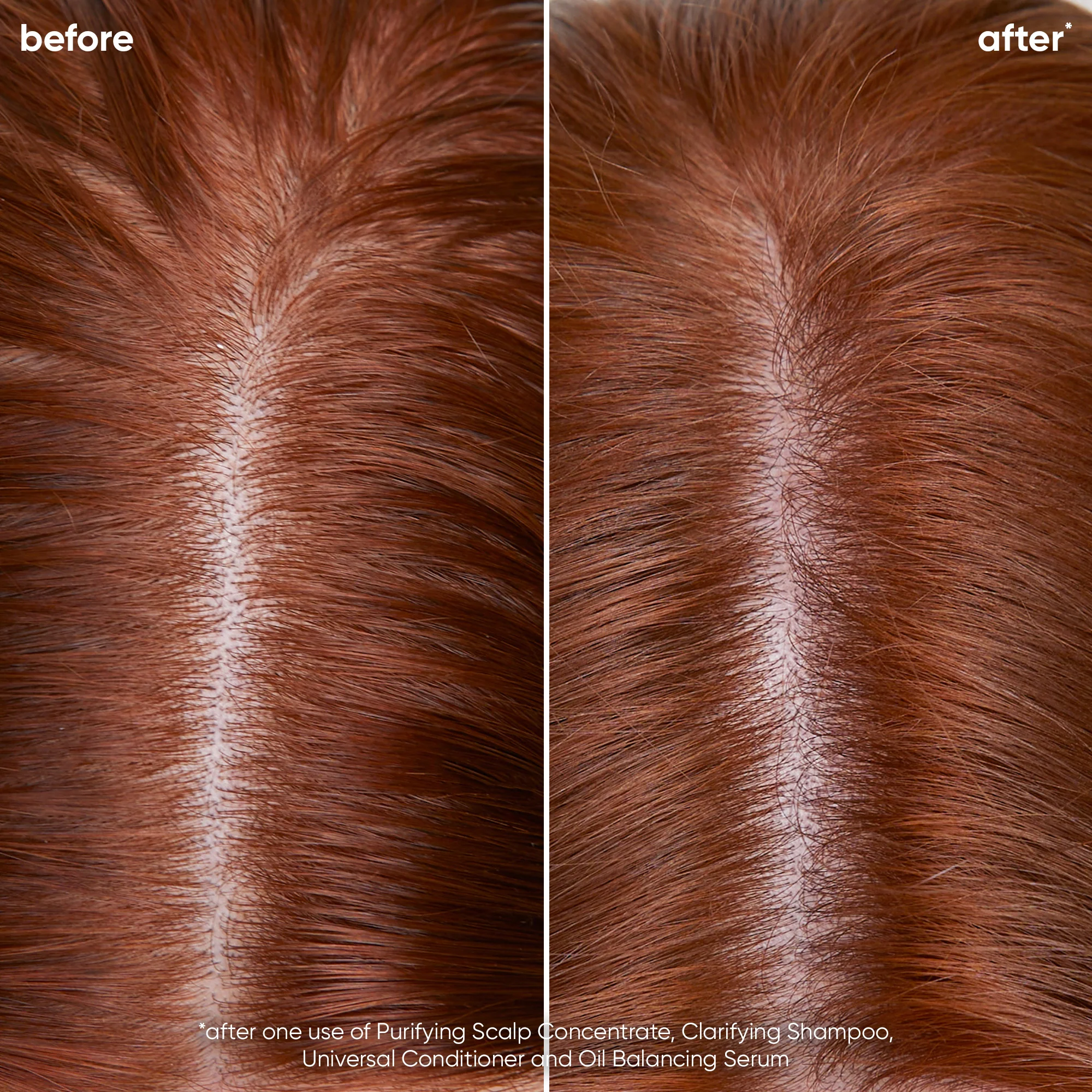 Scalp Sync Oil Balancing Serum 50ml - Image 6
