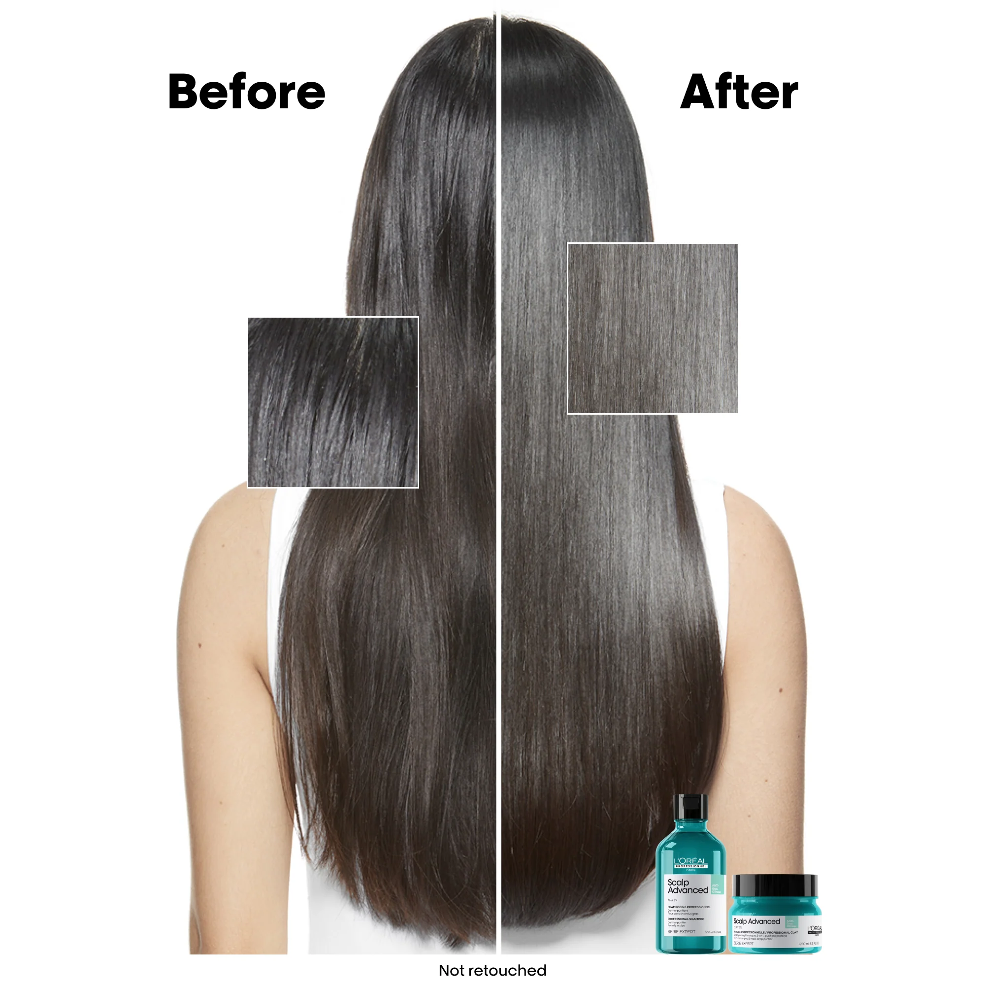 Scalp Advanced Oiliness Shampoo 300ml - Image 4