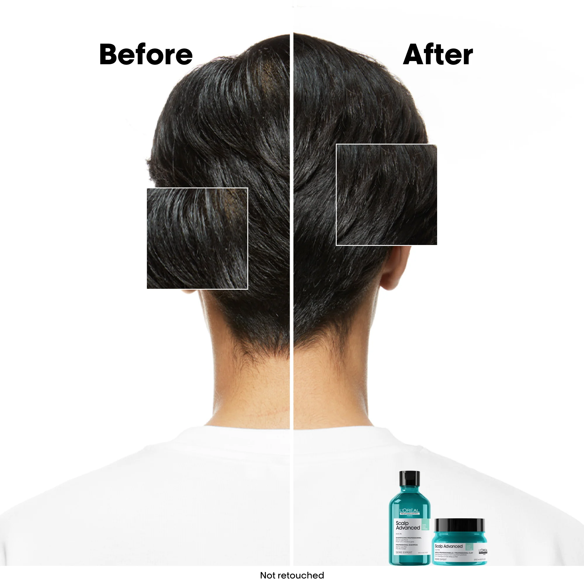 Scalp Advanced Oiliness Shampoo 300ml - Image 5