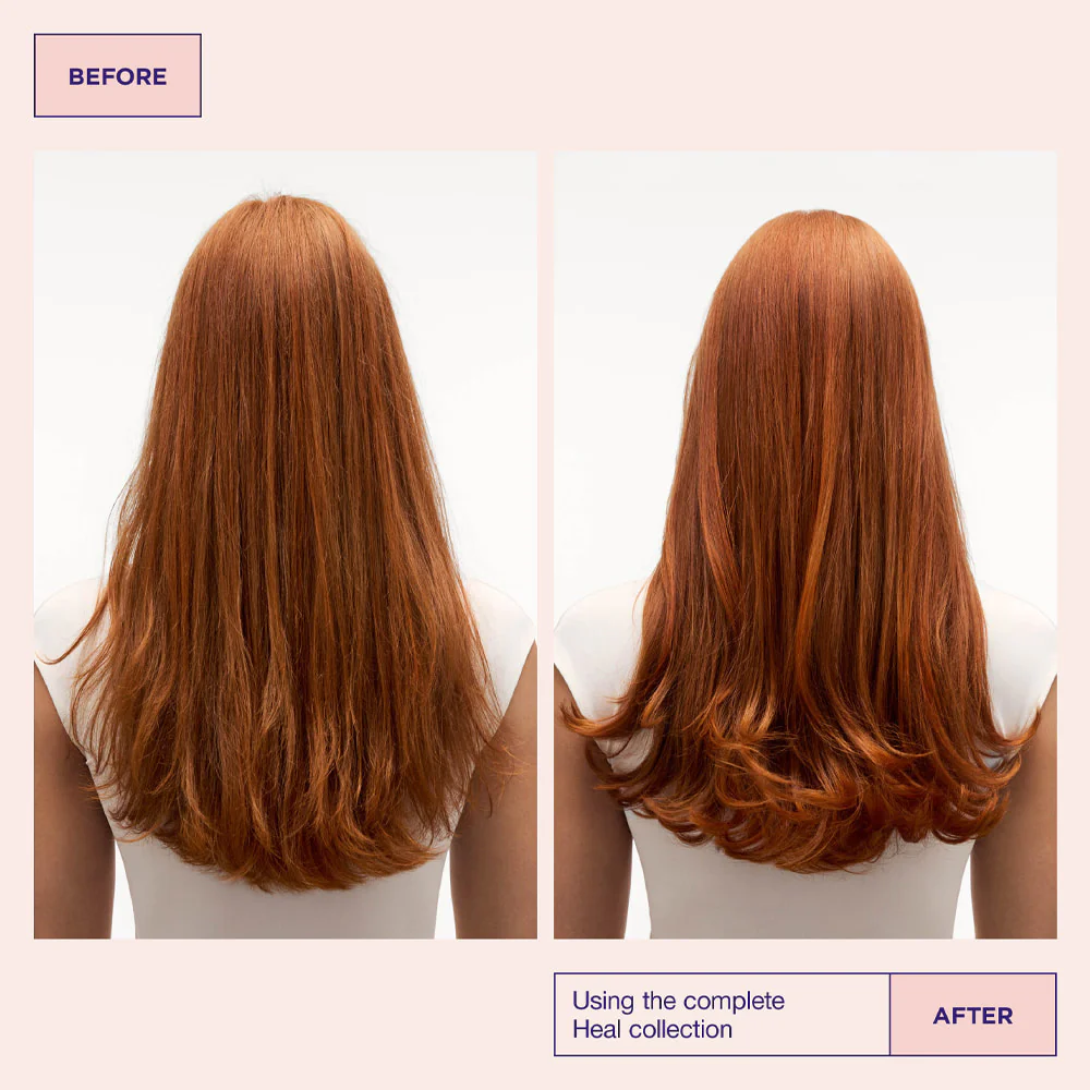 Head & Hair Heal Beauty Trio - Image 3