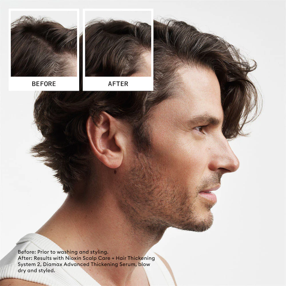 Scalp + Hair Thickening System 2 Full Size Trio - Image 6